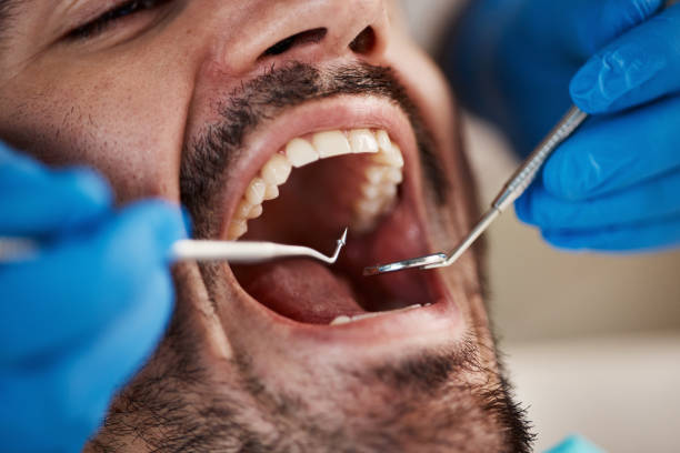 Best Emergency Dentist for Knocked-Out Tooth in Belding, MI