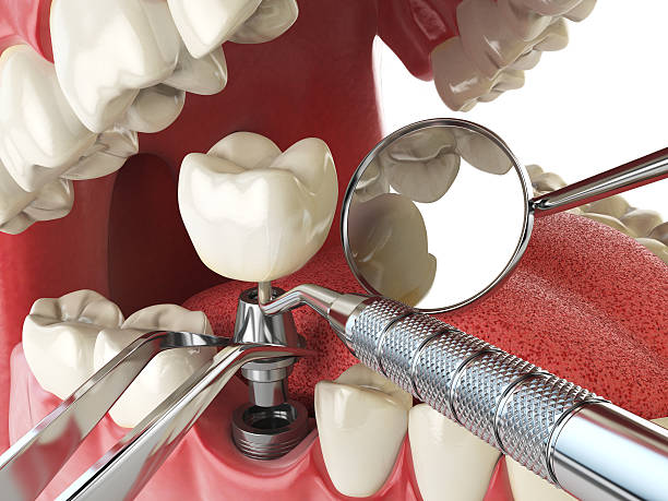 Best Mobile Emergency Dentist in Belding, MI